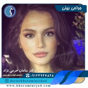 جراحی بینی - دکتر سامان خرمی نژاد
