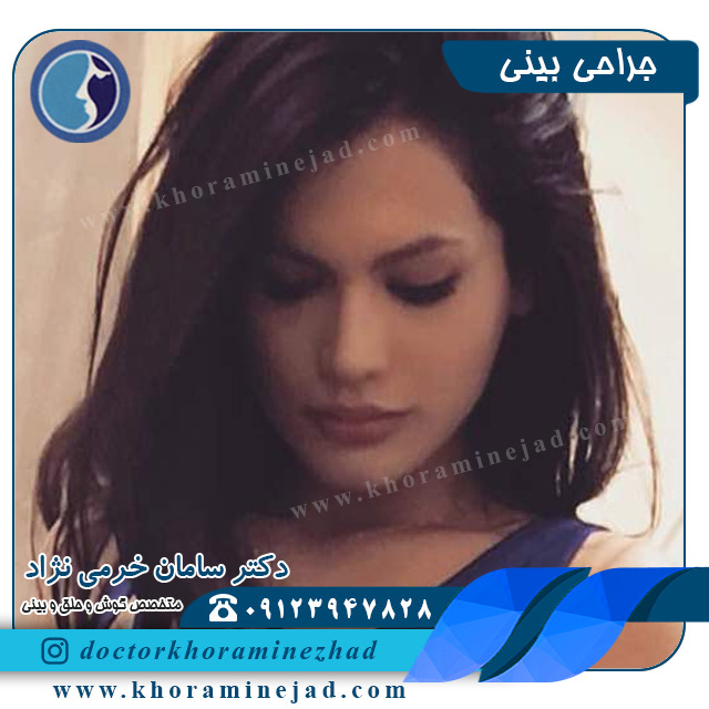 جراحی بینی نچرال