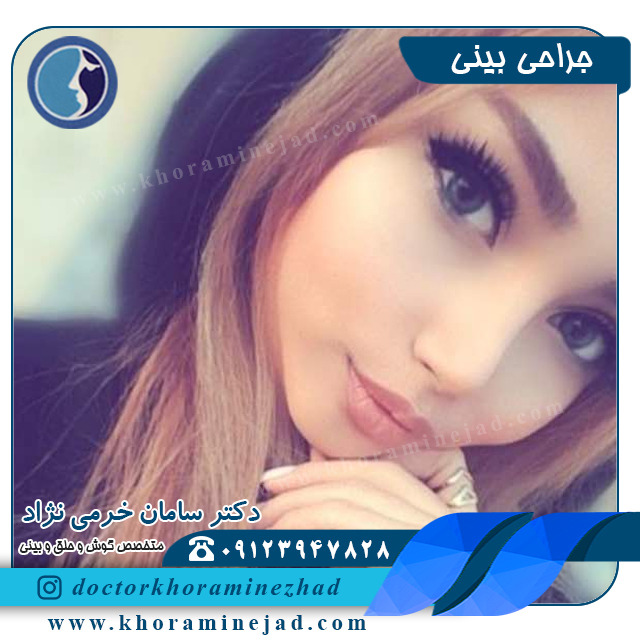 جراحی بینی عروسکی