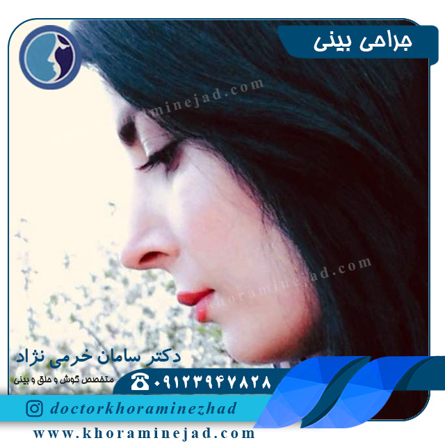 جراحی بینی طبیعی