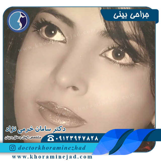 جراحی بینی-نمونه کار