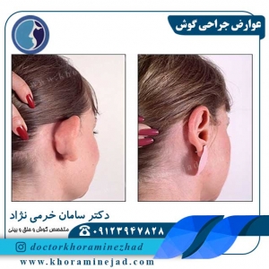 عوارض-جراحی-گوش