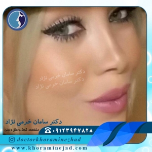 نمونه جراحی بینی