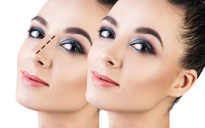 نقش غضروف در عمل بینی چیست؟