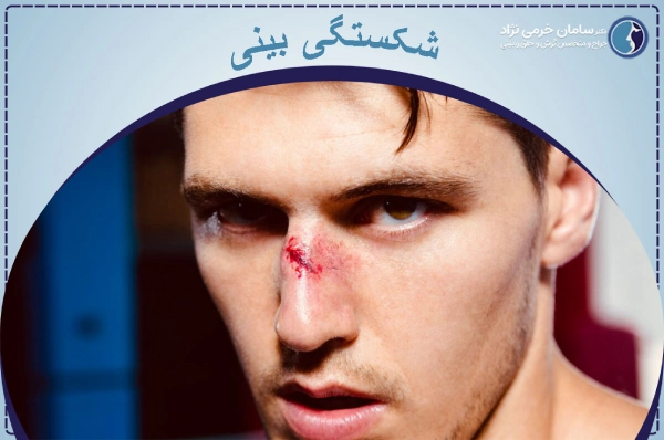 شکستگی بینی