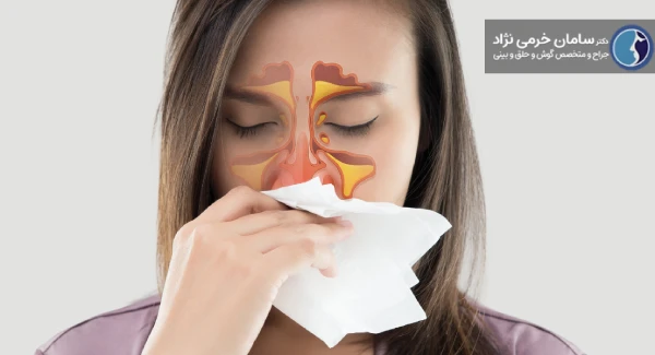 سینوزیت چیست؟