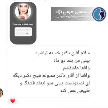 رضایت عمل جراحی بینی توسط دکتر خرمی نژاد