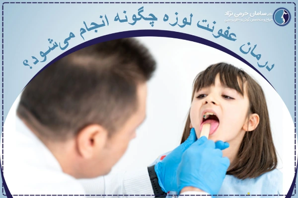 درمان عفونت لوزه