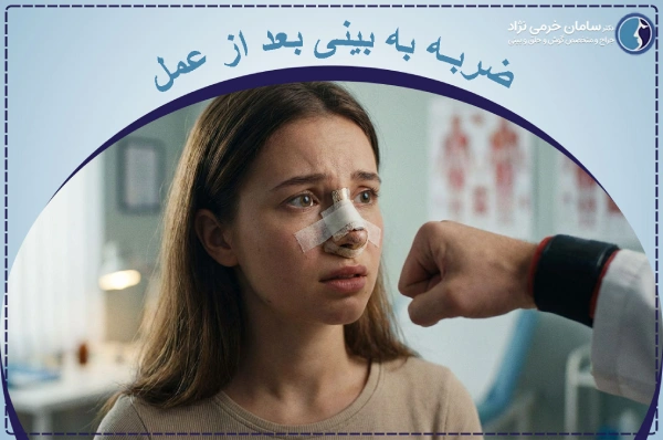 ضربه به بینی بعد از عمل چگونه است